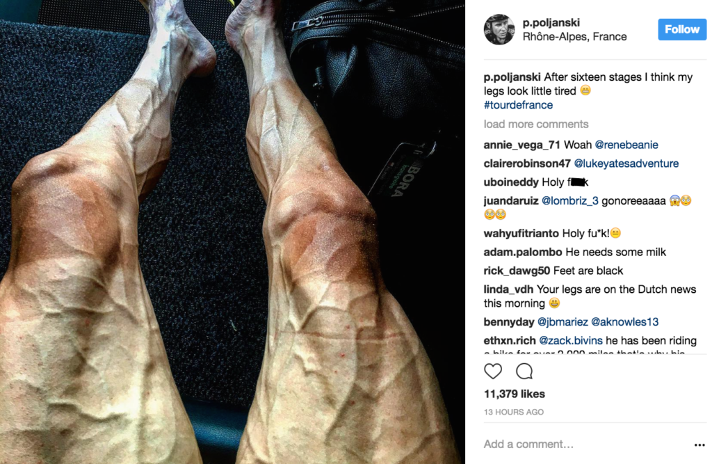 Cyclist shares ALARMING photo of himself during Tour de France